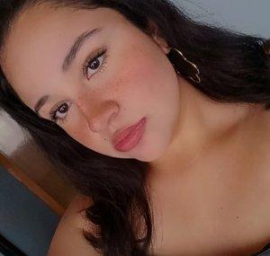 Freckles