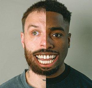 TGFbro