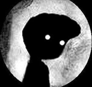BlindSniperGigz