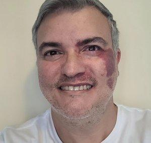 Rafael Poggi