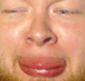Enormous Ginger