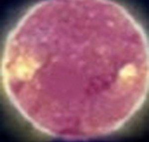 PurpleSun