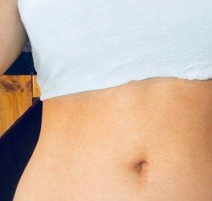 navel chic