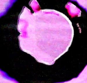 VITRIOL