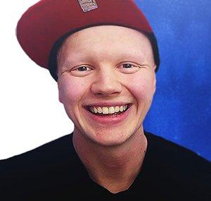 Tom Talks Alopecia