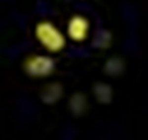 dbvxy