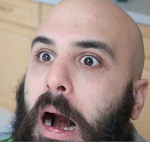 OddballMattsVeeLog