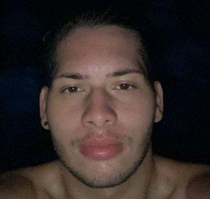 Acalabianqui
