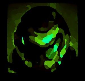 Eyeiszik