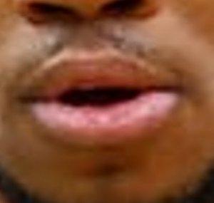 the poggers mouth of giannis antecope